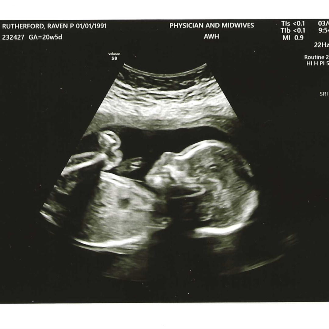 Photo shared by Raven for their Babylist baby registry.