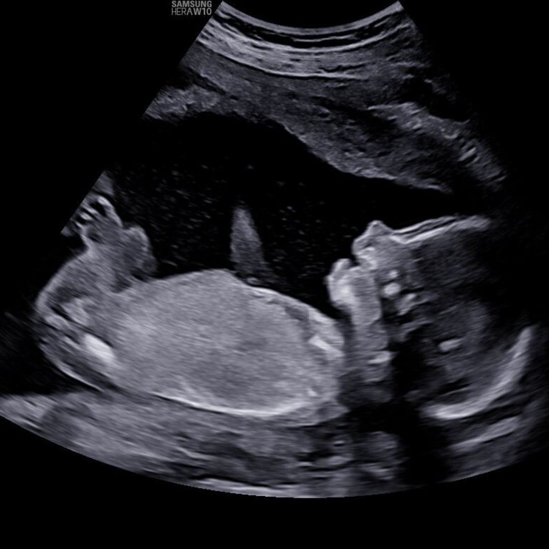 Photo shared by Tristen for their Babylist baby registry.