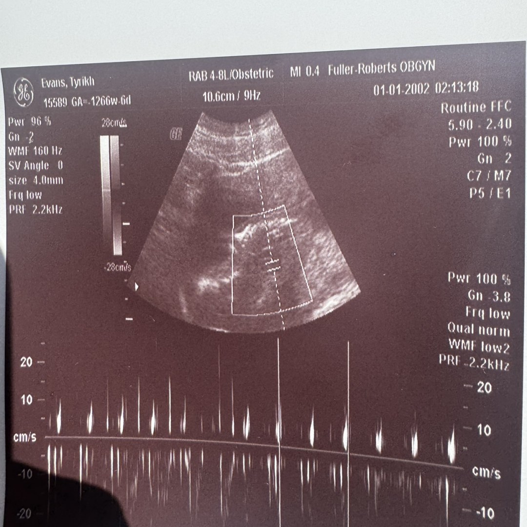 Photo shared by Danni for their Babylist baby registry.