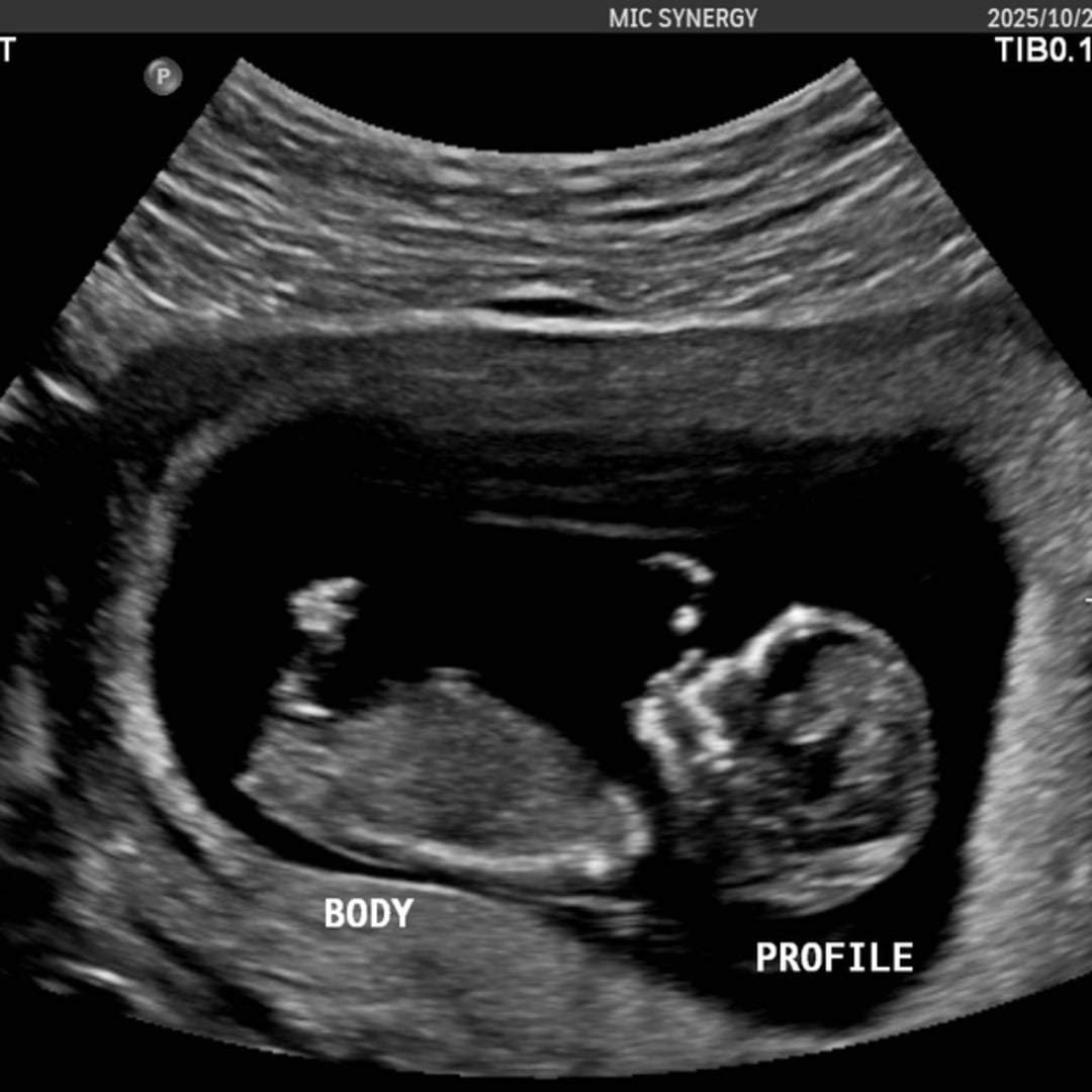 Photo shared by Sara for their Babylist baby registry.