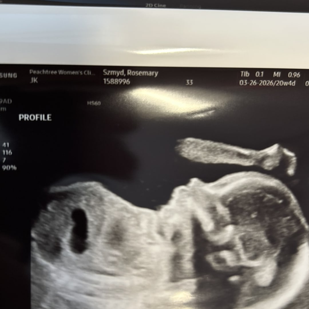 Photo shared by Rosie for their Babylist baby registry.