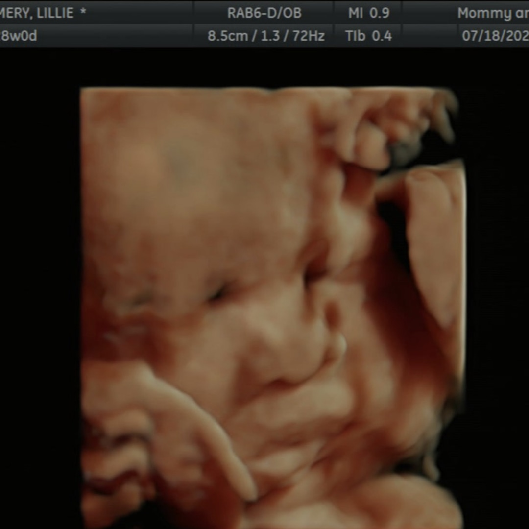 Photo shared by Lillian for their Babylist baby registry.