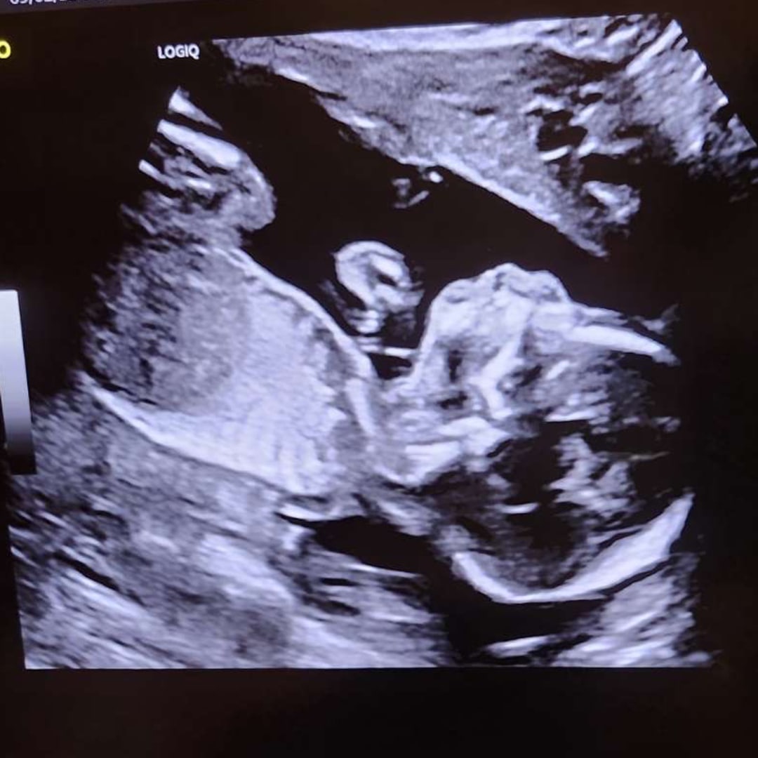 Photo shared by Meagan for their Babylist baby registry.