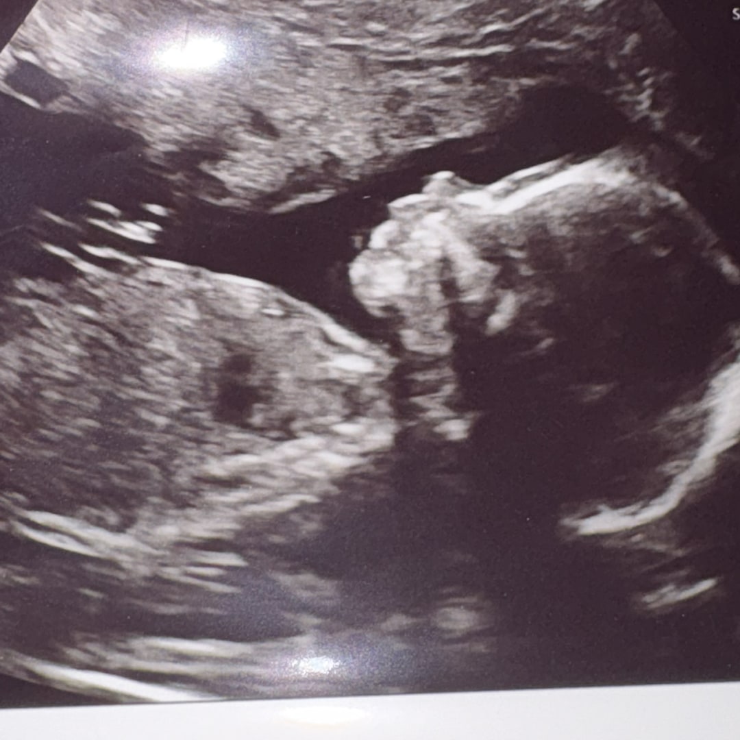 Photo shared by Cecily for their Babylist baby registry.