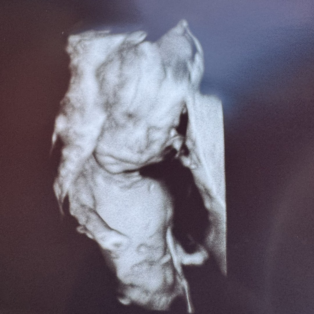 Photo shared by Felicia for their Babylist baby registry.