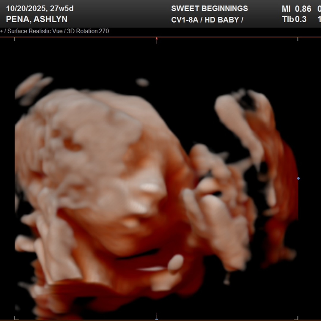 Photo shared by Ashlyn for their Babylist baby registry.