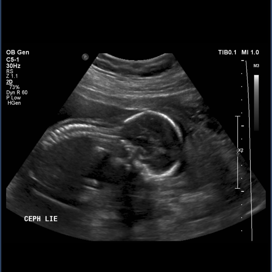 Photo shared by Ashanti for their Babylist baby registry.