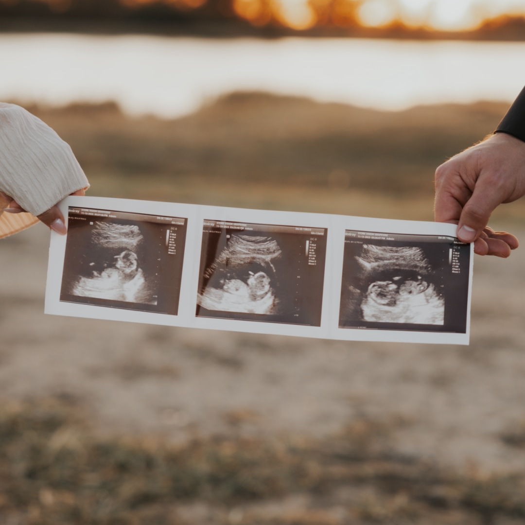 Photo shared by Gina for their Babylist baby registry.