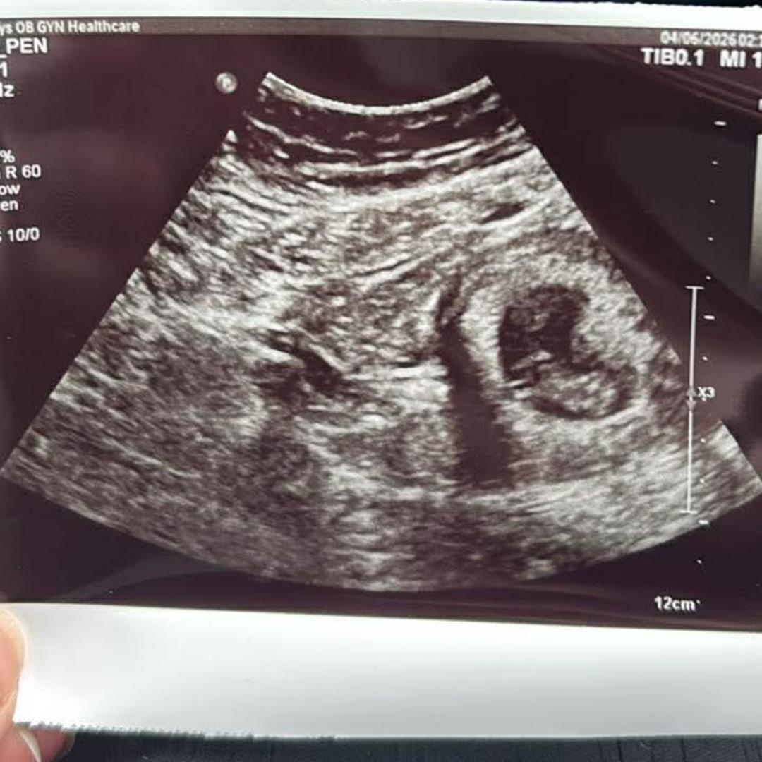 Photo shared by Allie for their Babylist baby registry.