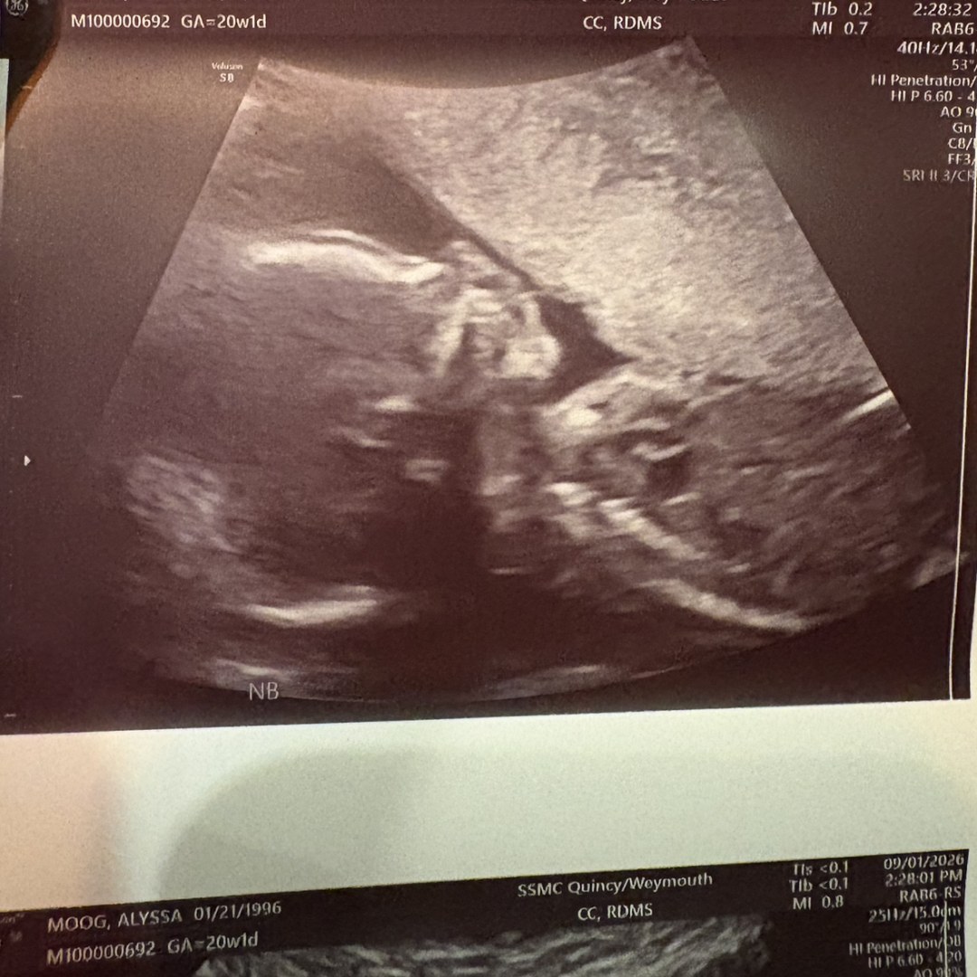 Photo shared by Alyssa for their Babylist baby registry.