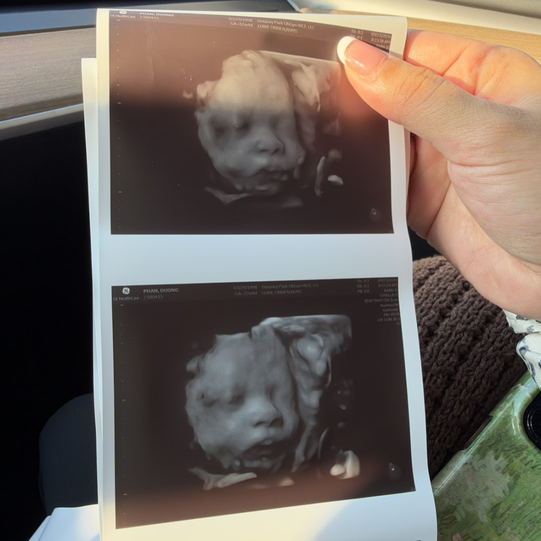 Photo shared by Kit for their Babylist baby registry.