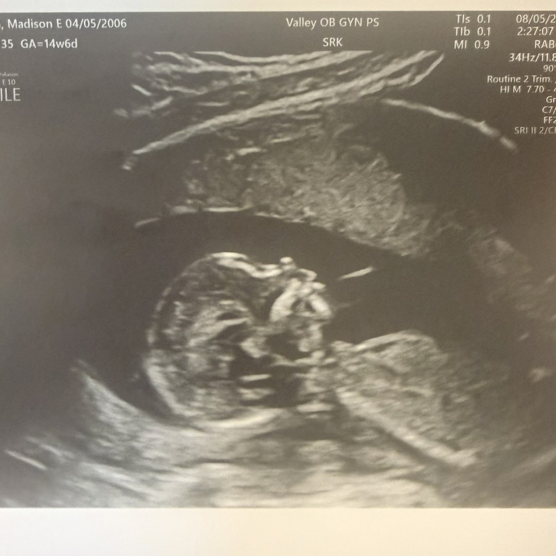 Photo shared by Madison for their Babylist baby registry.