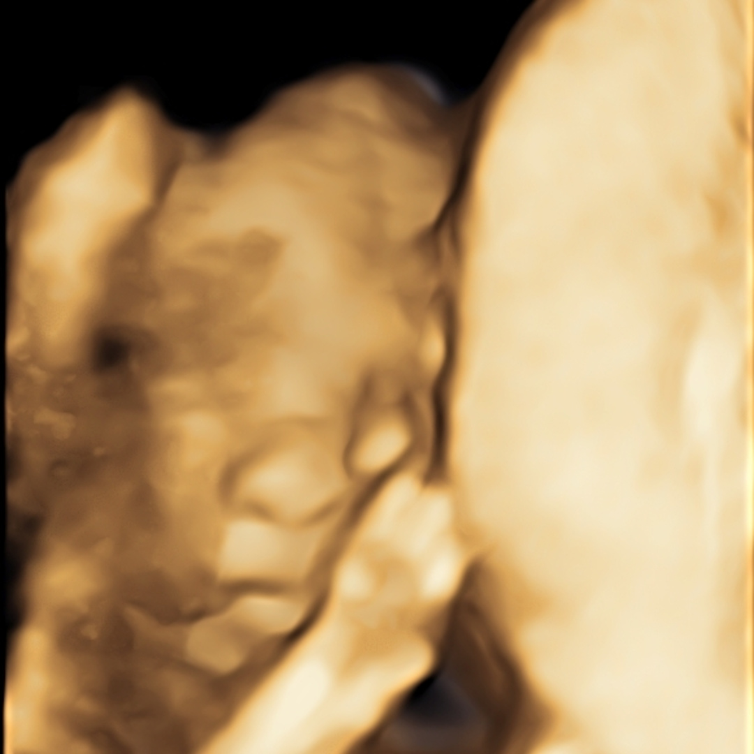 Photo shared by Autumn for their Babylist baby registry.