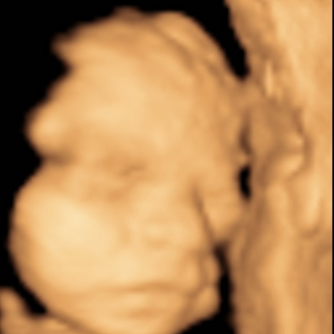 Photo shared by Kailyn for their Babylist baby registry.