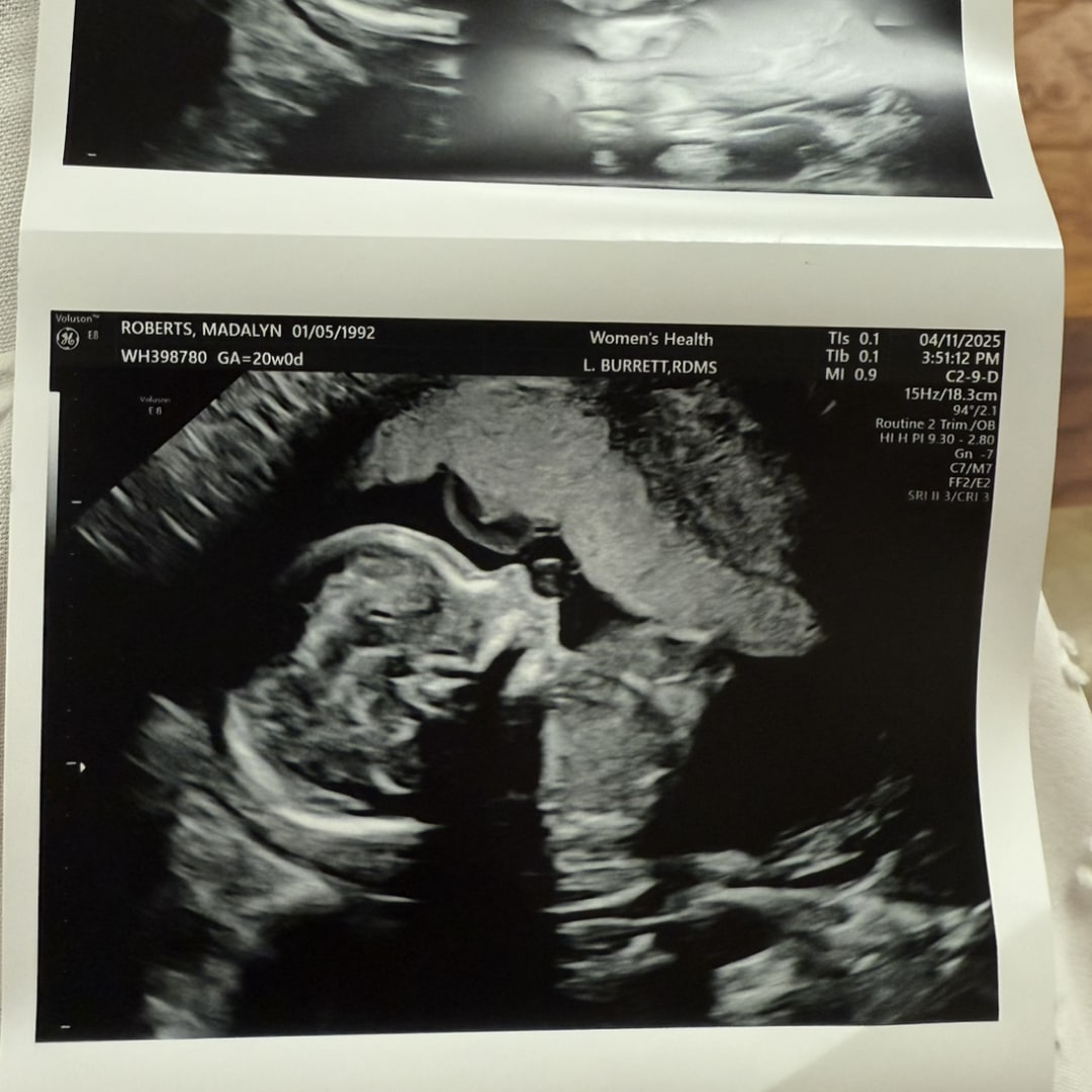 Photo shared by Madalyn for their Babylist baby registry.