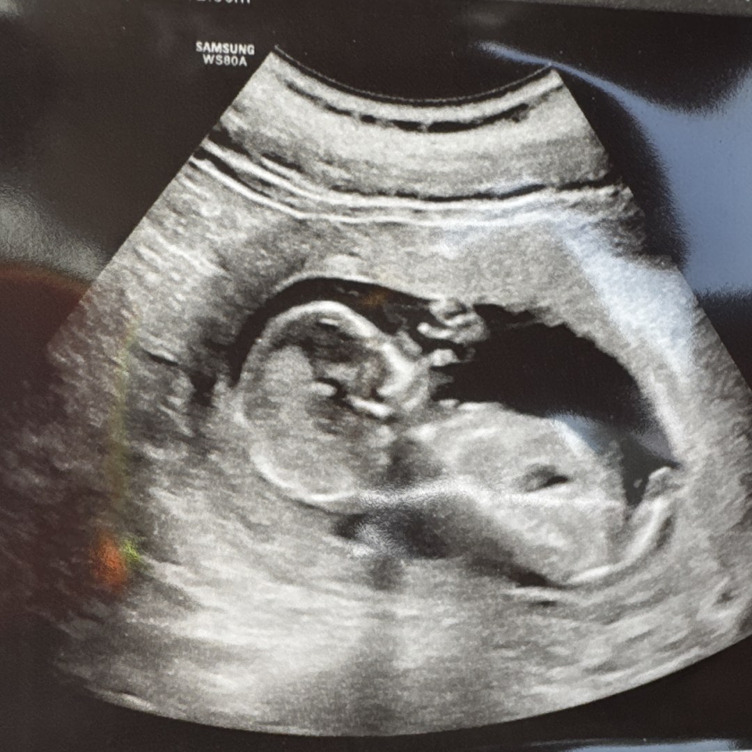 Photo shared by Corinna for their Babylist baby registry.