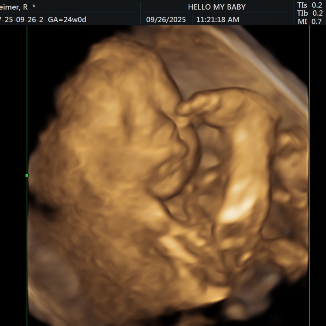 Photo shared by Rebecca for their Babylist baby registry.