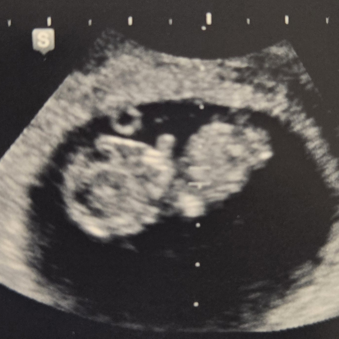 Photo shared by Izela for their Babylist baby registry.