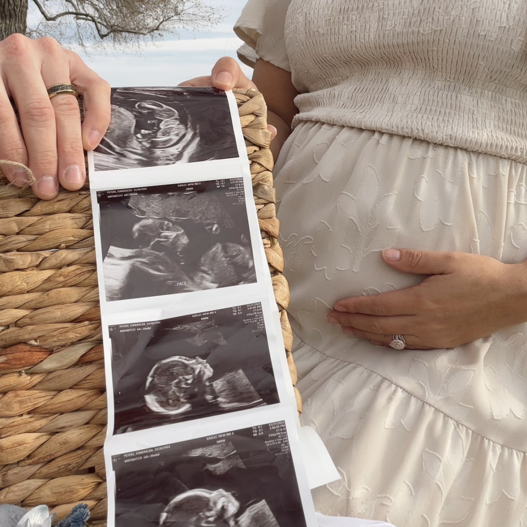 Photo shared by Esmeralda for their Babylist baby registry.