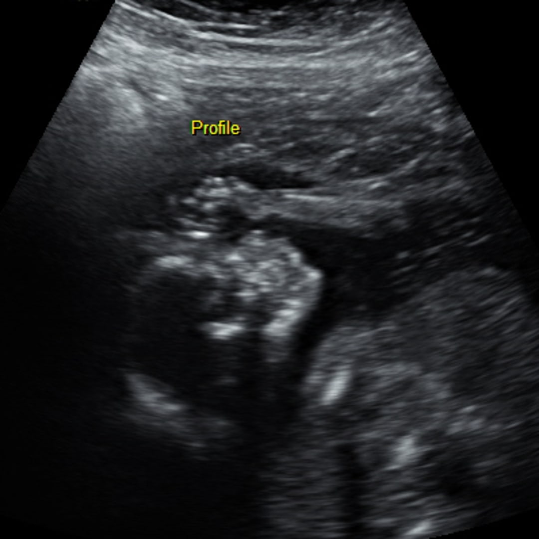 Photo shared by Creighton for their Babylist baby registry.
