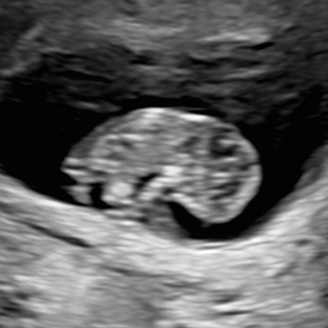 Photo shared by Aurora for their Babylist baby registry.