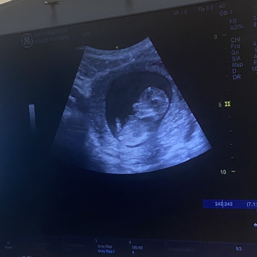 Photo shared by Asia for their Babylist baby registry.