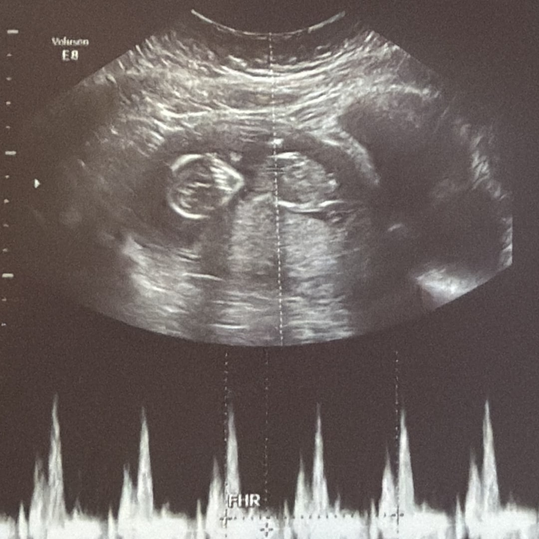 Photo shared by Jennifer for their Babylist baby registry.