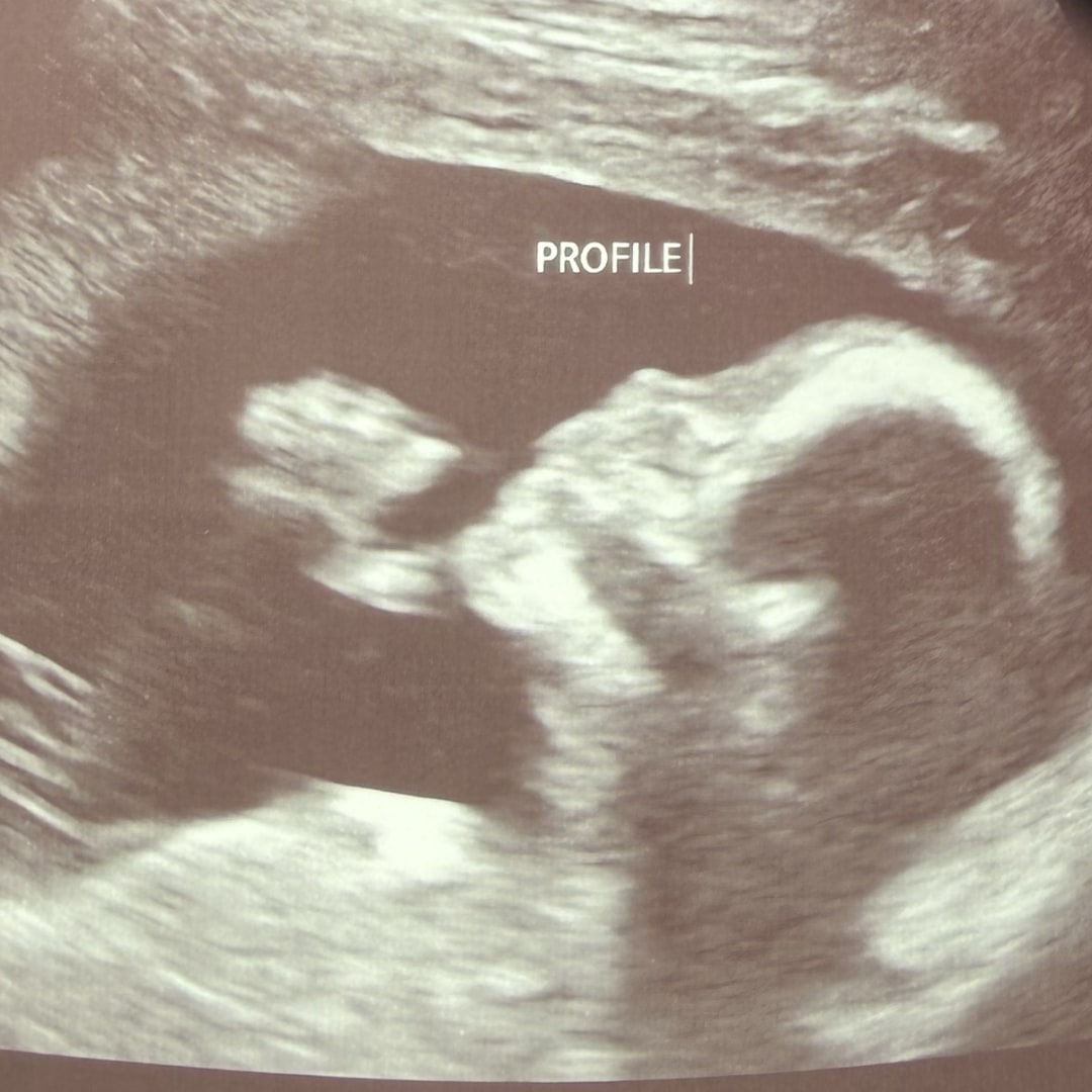 Photo shared by Maddie for their Babylist baby registry.