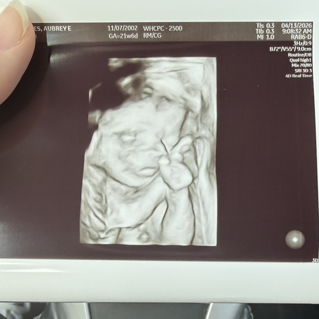 Photo shared by Aubrey for their Babylist baby registry.