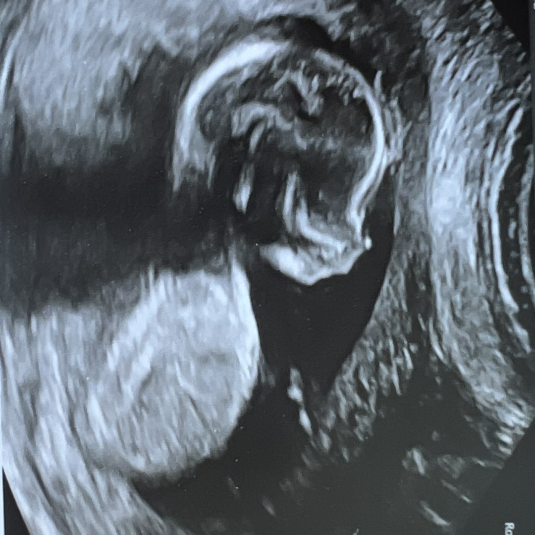 Photo shared by Zitlaly for their Babylist baby registry.