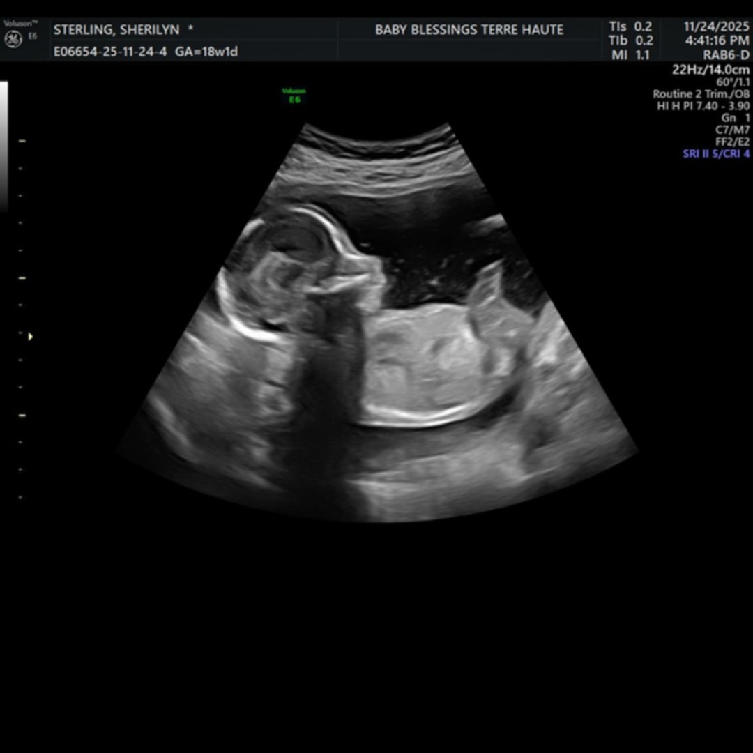 Photo shared by Sherilyn for their Babylist baby registry.