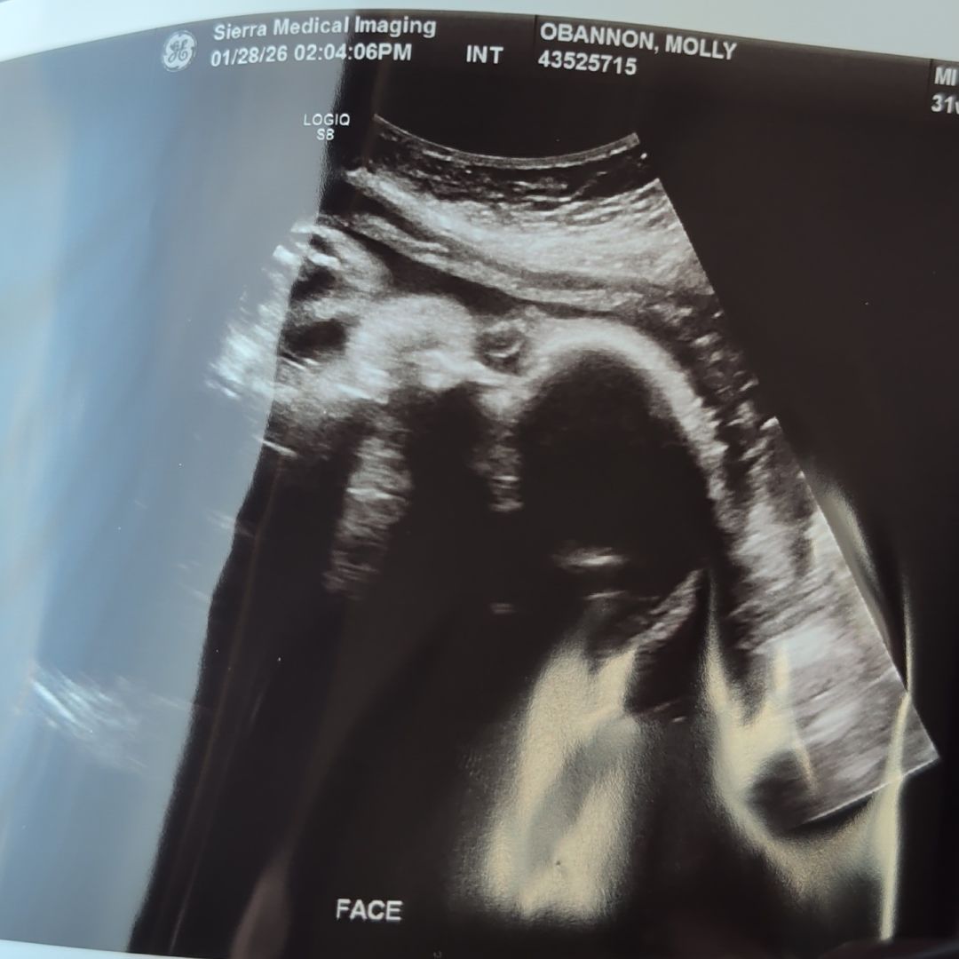Photo shared by Molly for their Babylist baby registry.