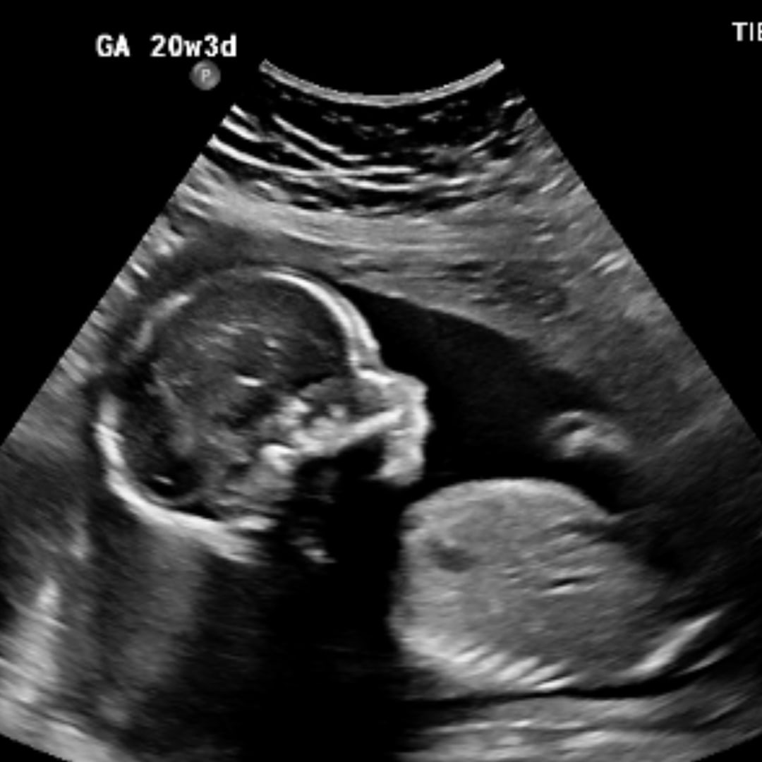Photo shared by Brit for their Babylist baby registry.