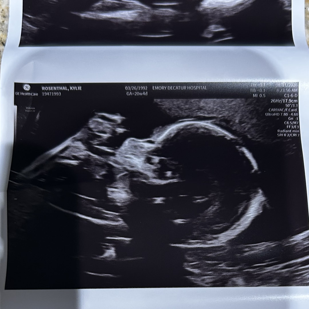 Photo shared by Kylie for their Babylist baby registry.