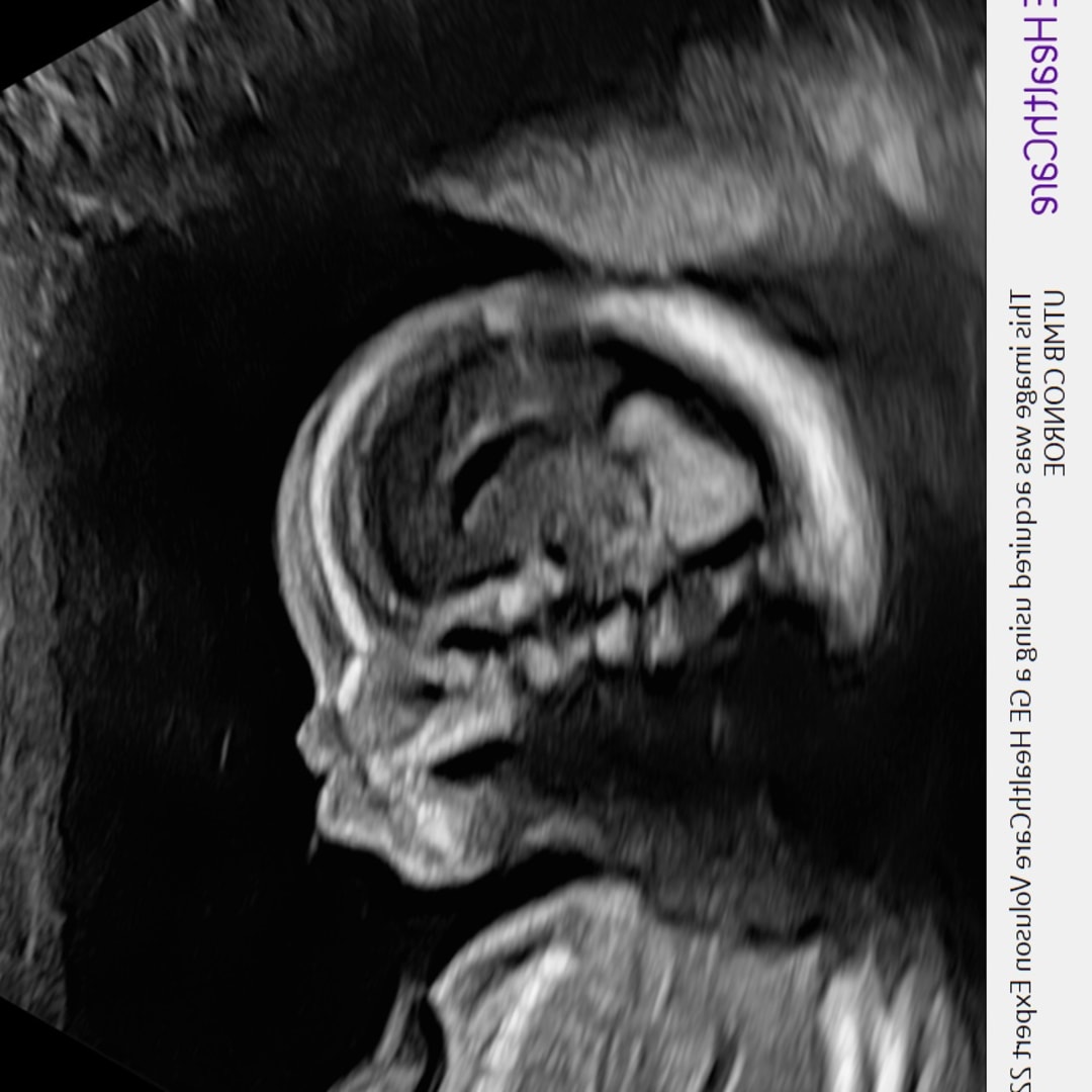 Photo shared by Nihlze for their Babylist baby registry.