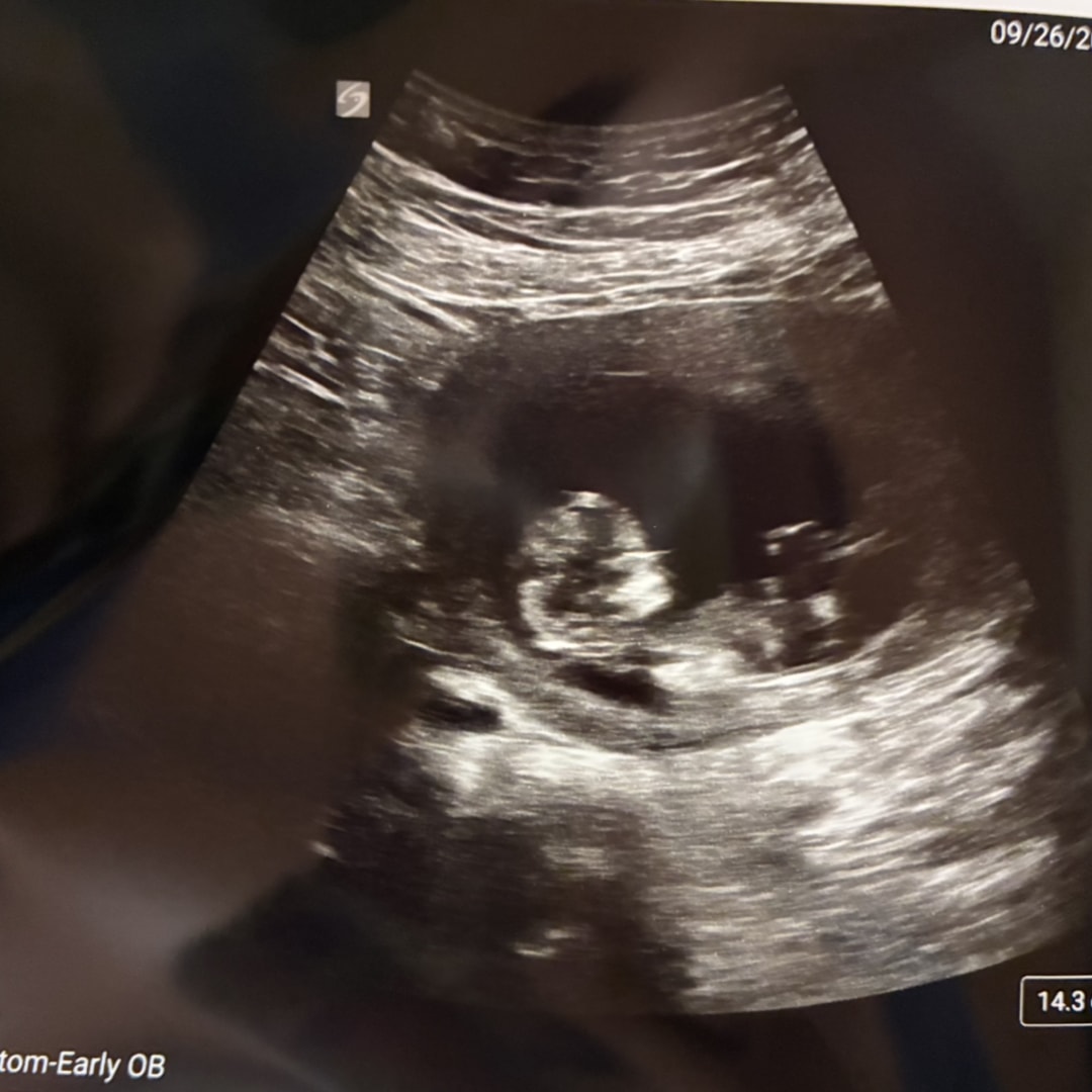 Photo shared by Chelsea for their Babylist baby registry.