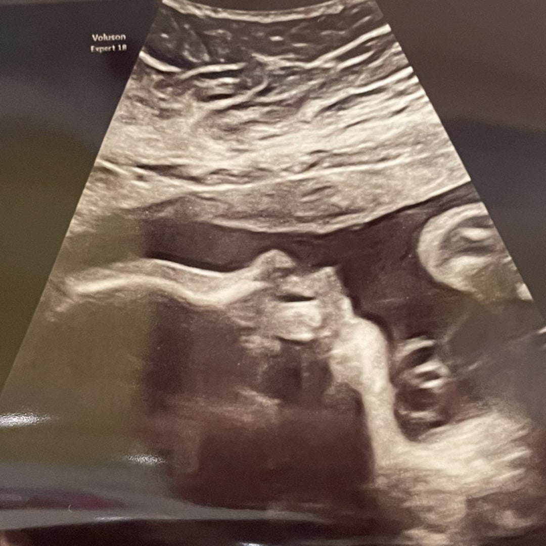 Photo shared by Kasey for their Babylist baby registry.