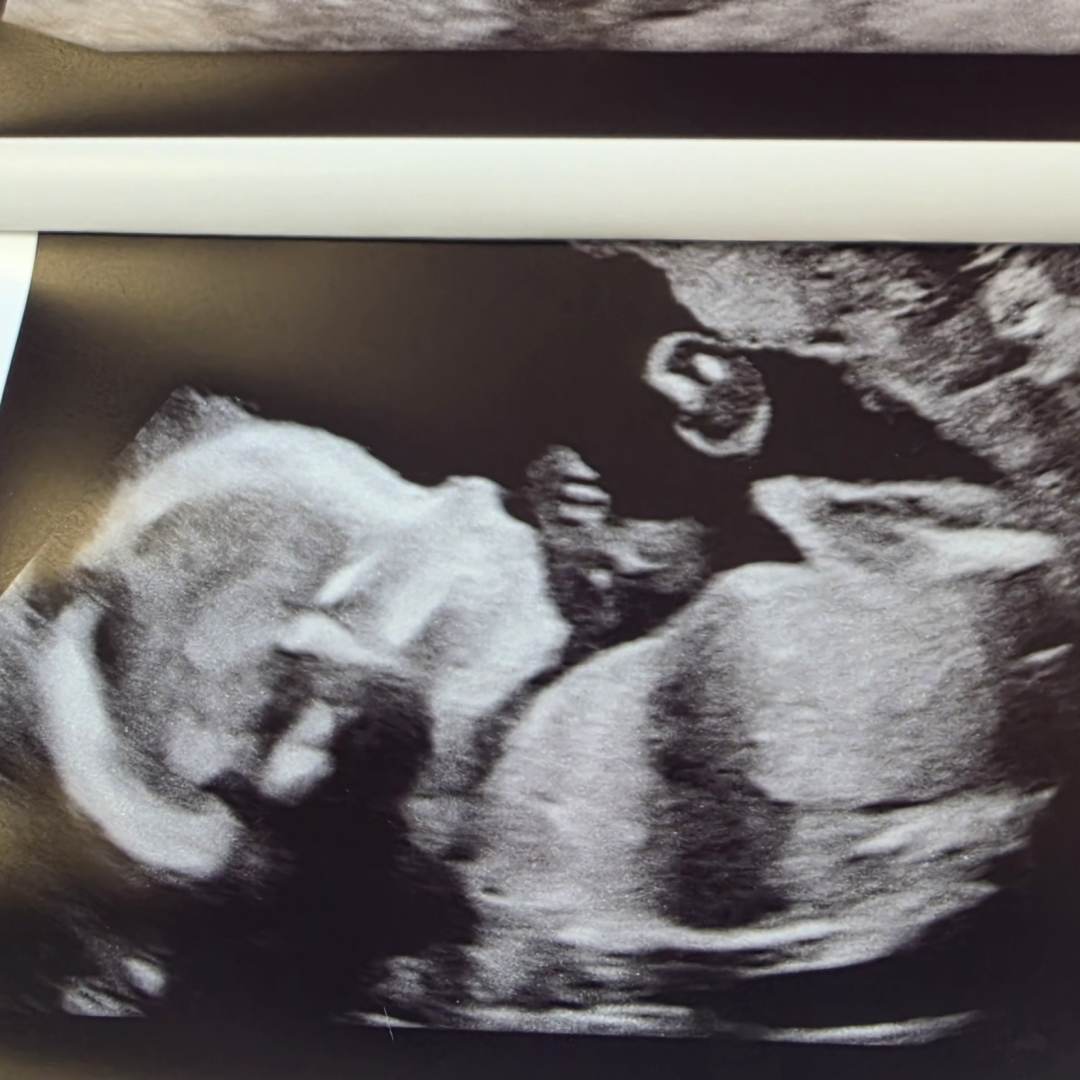 Photo shared by Grace for their Babylist baby registry.