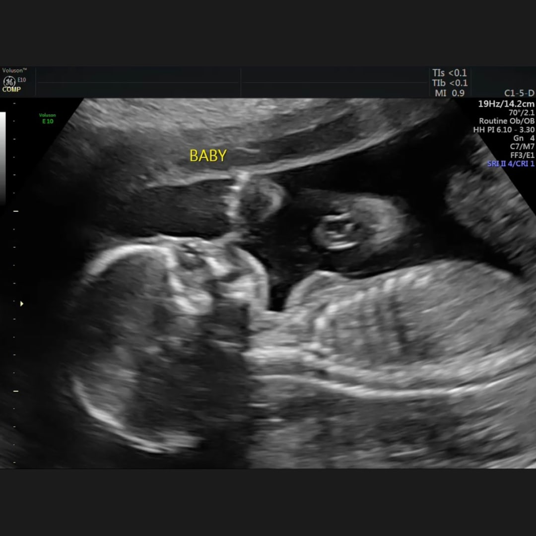 Photo shared by Caitlin for their Babylist baby registry.