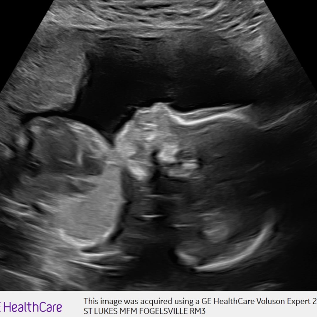 Photo shared by Hayley for their Babylist baby registry.