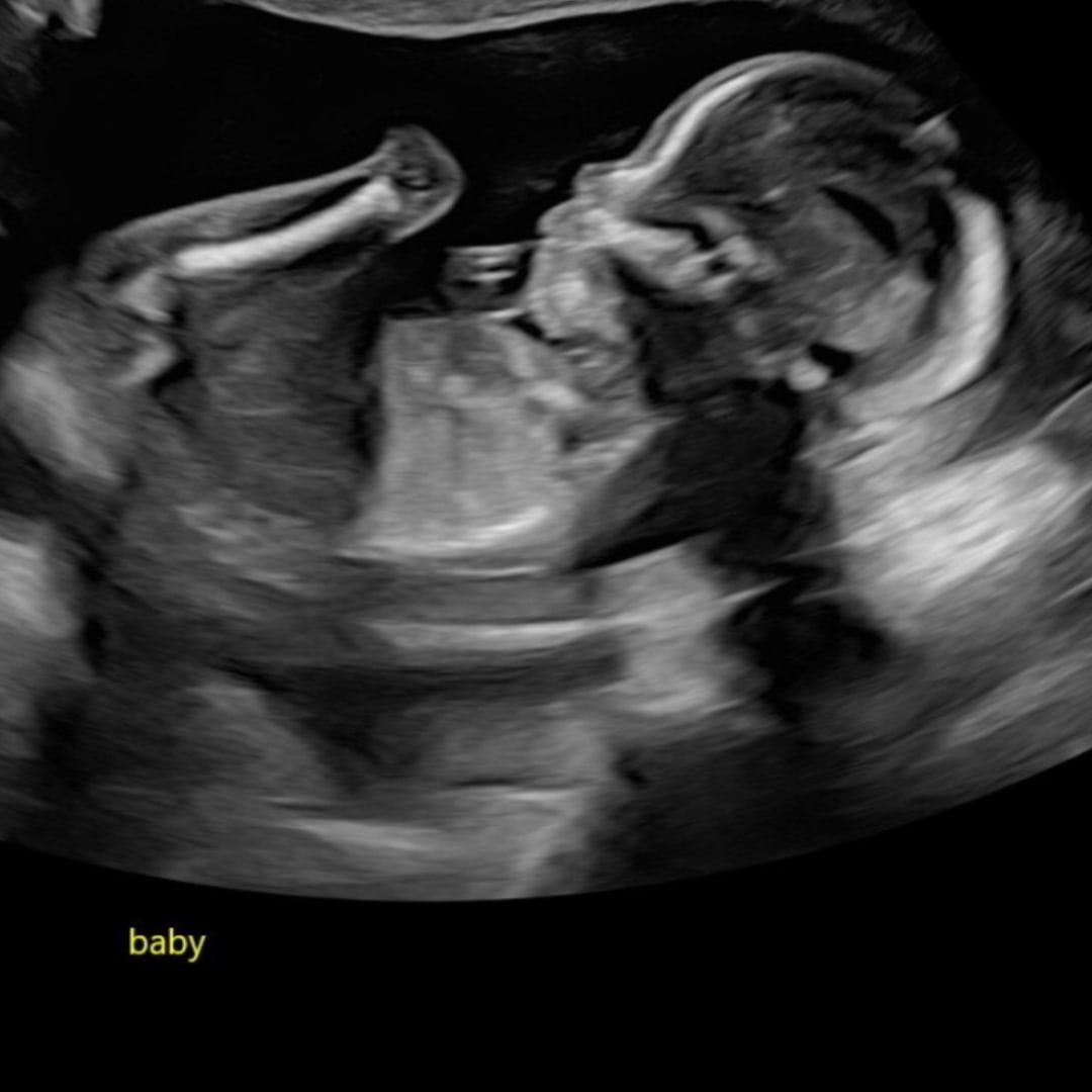 Photo shared by Audriana for their Babylist baby registry.