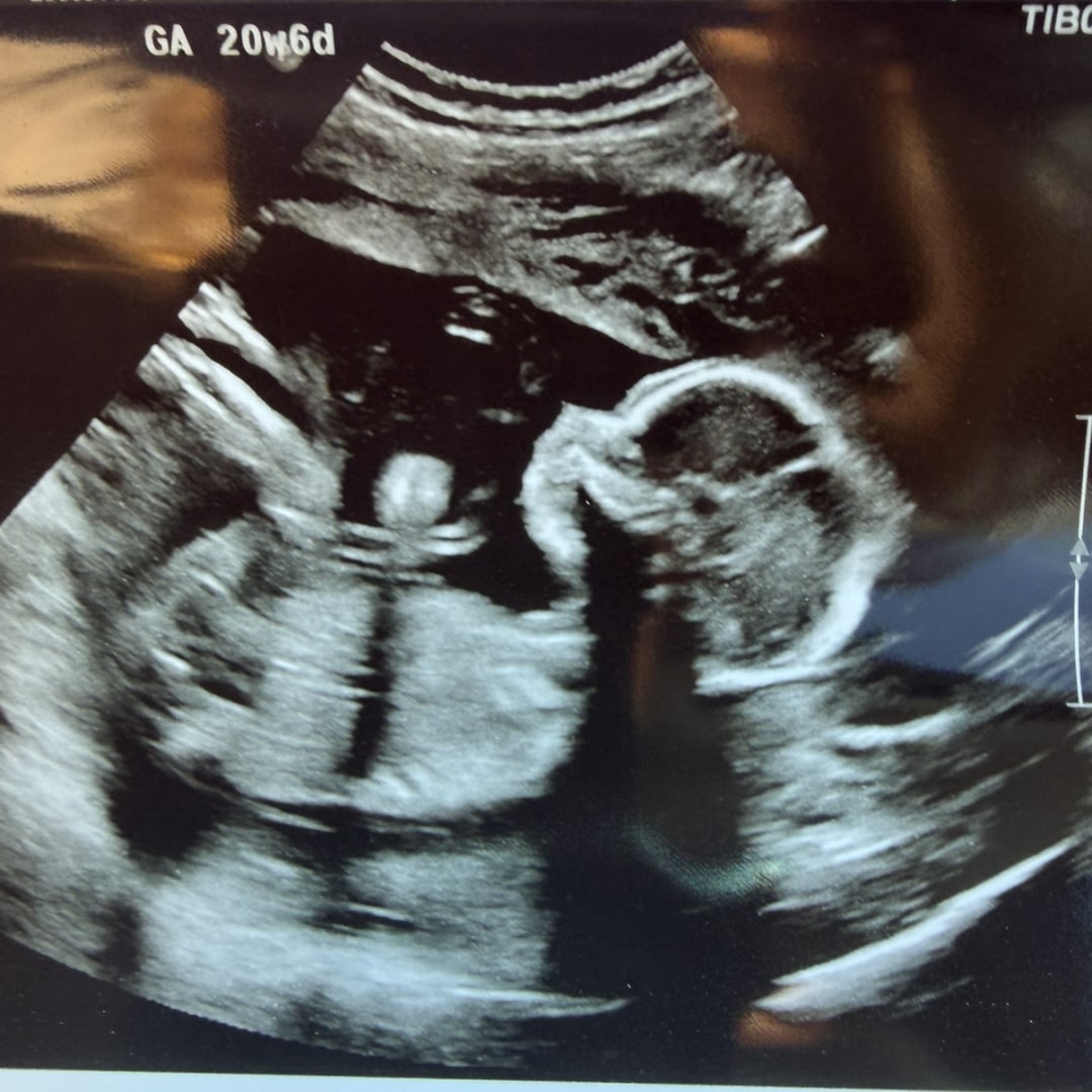 Photo shared by Alyssa for their Babylist baby registry.