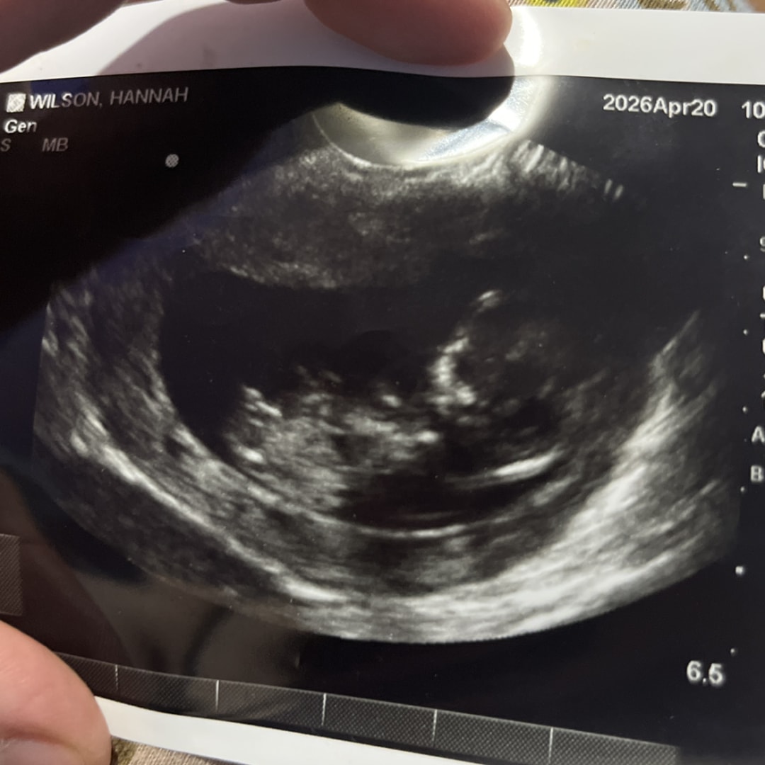 Photo shared by Hannah for their Babylist baby registry.