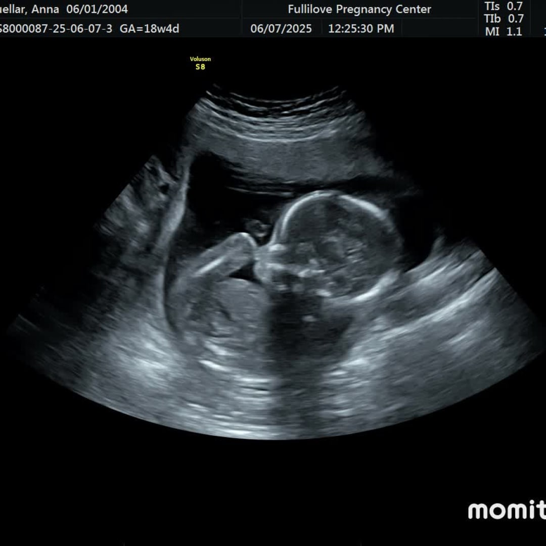Photo shared by Anita for their Babylist baby registry.