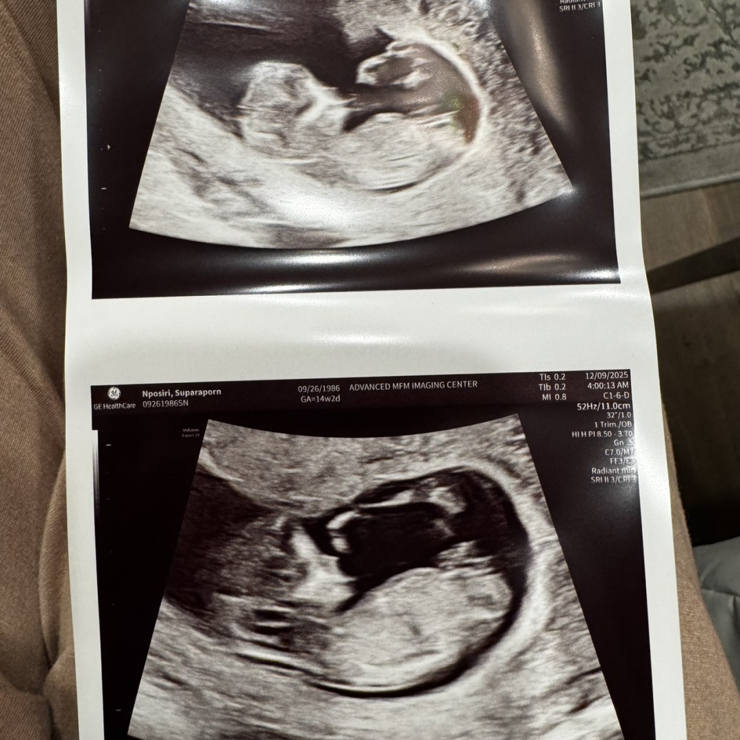 Photo shared by Emma for their Babylist baby registry.