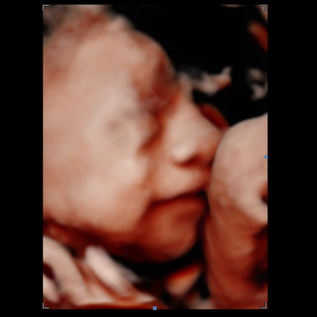 Photo shared by Megan for their Babylist baby registry.