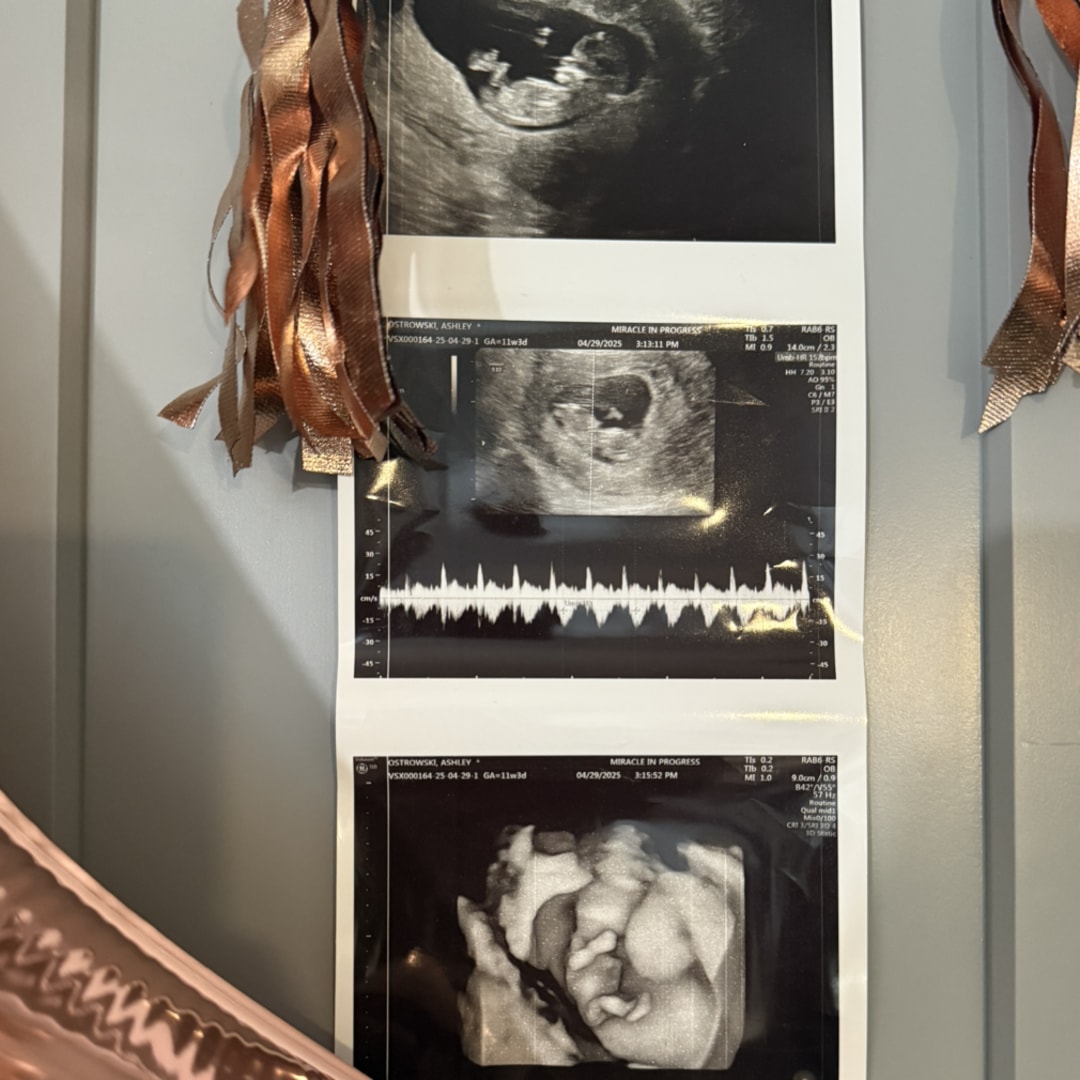 Photo shared by Ashley for their Babylist baby registry.