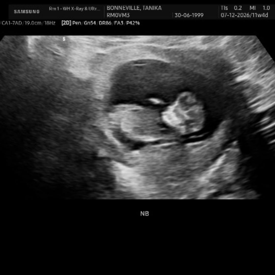 Photo shared by Tanika for their Babylist baby registry.