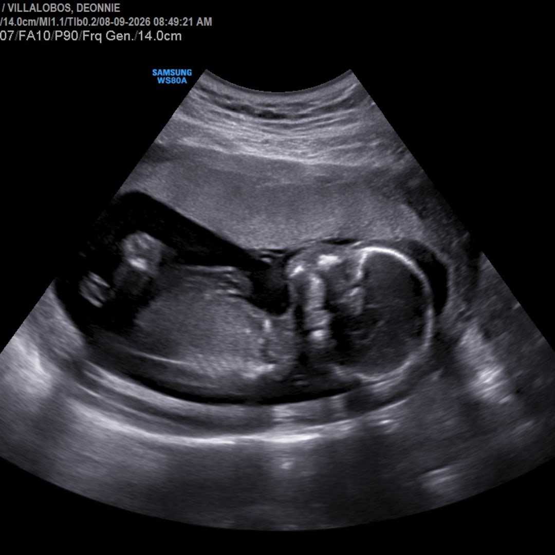 Photo shared by Deonnie for their Babylist baby registry.