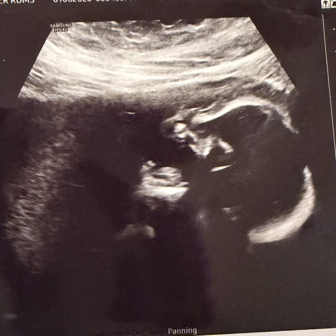 Photo shared by Teris for their Babylist baby registry.